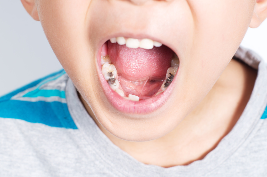 Giving Your Child Sugar Avoid These Costly Errors - 21rg6ap